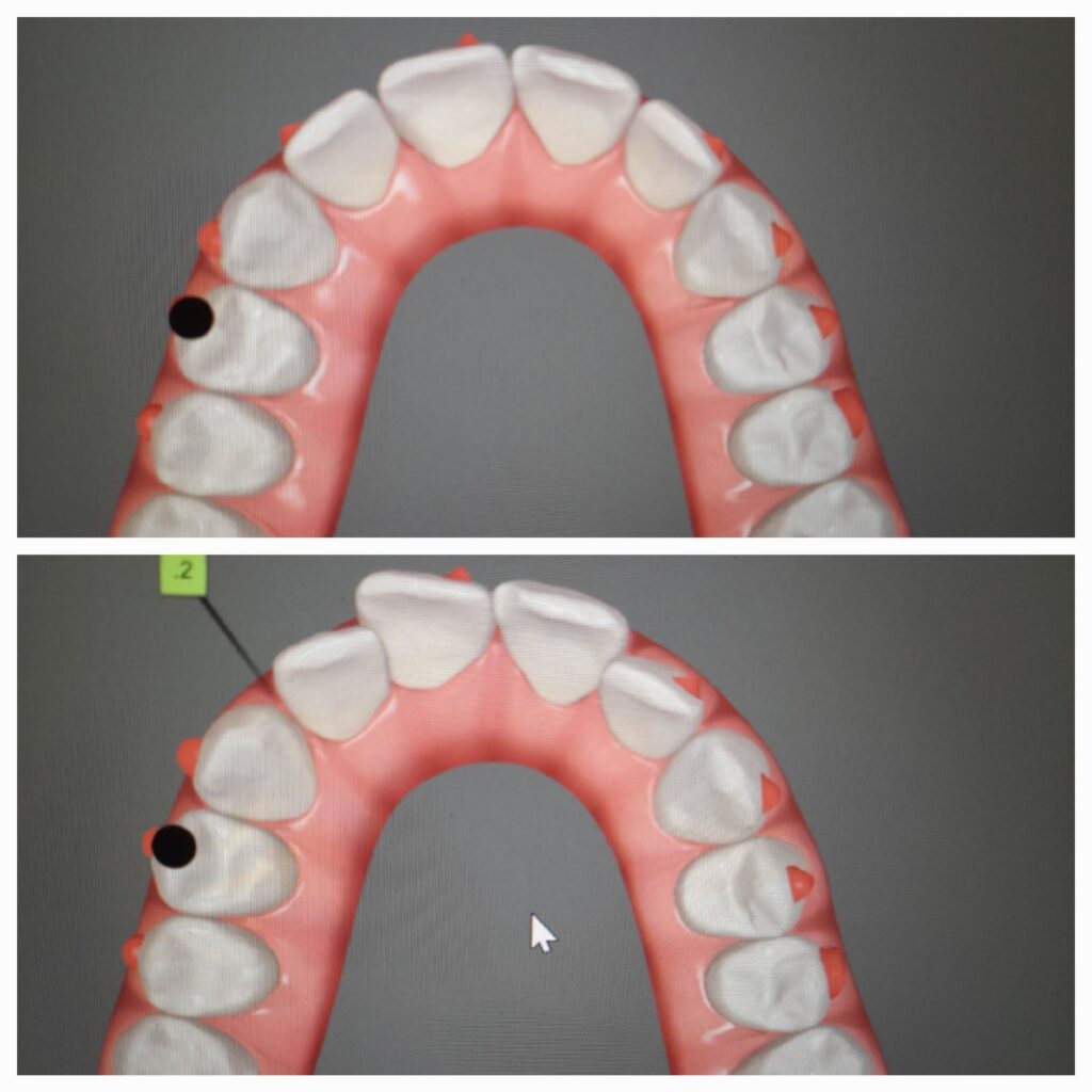 apparecchio dentale