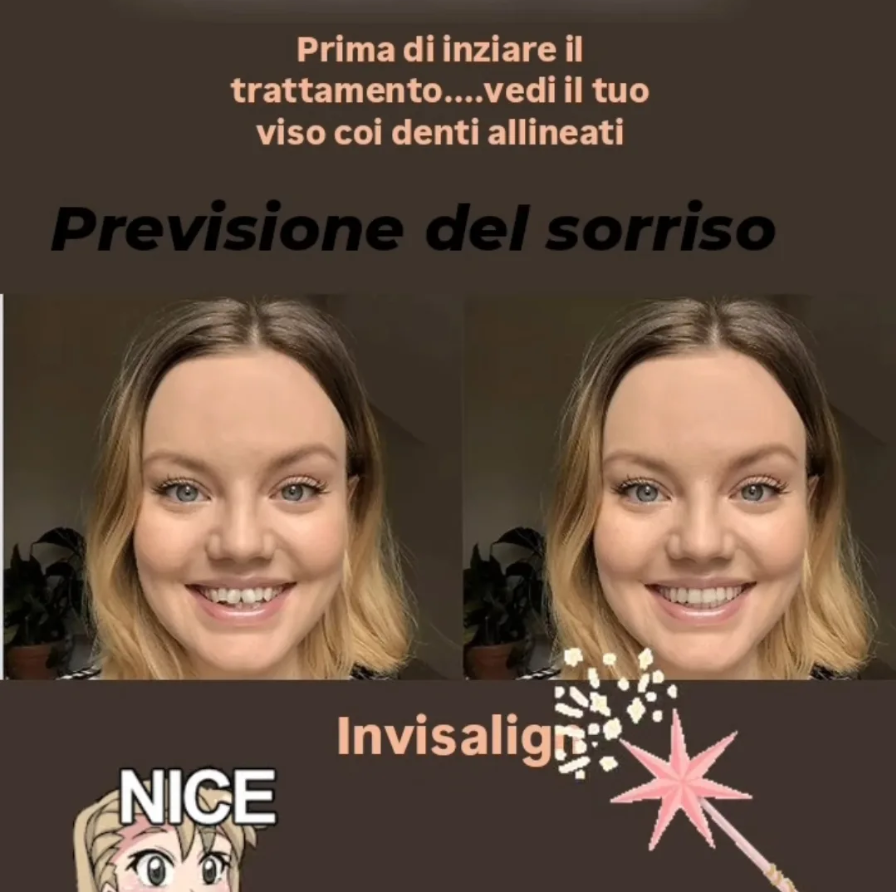 smile designing